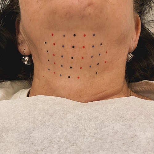 men Under Chin Tattoo 2