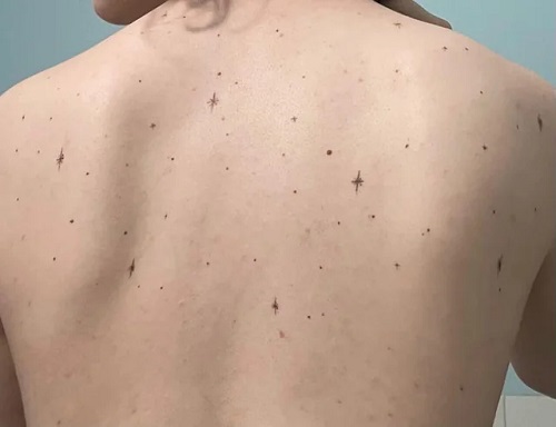 women Freckle Tattoo 2