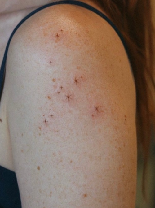 women Freckle Tattoo